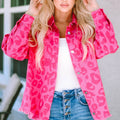 Pink Leopard Print Button Cuffs Raw Hem Jacket - Foto 5