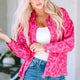 Roze Luipaardprint Print Knoop Cuffs Raw Hem Jasje